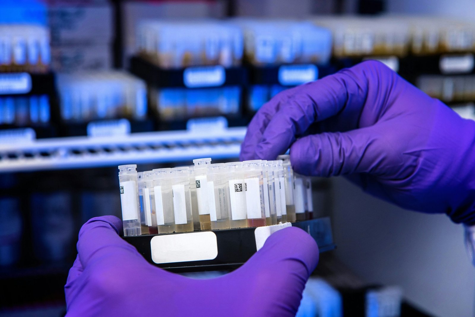 Gloved hands organizing diagnostic specimen vials in a medical laboratory for advanced metabolic and hormonal testing.